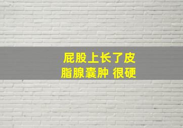 屁股上长了皮脂腺囊肿 很硬